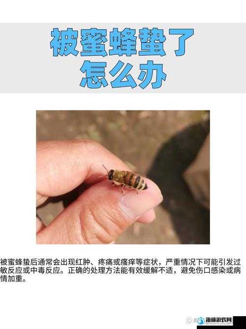 被蜜蜂蛰了怎么办，治愈方法分享：动物森友会玩家必看的应急处理与误区解析